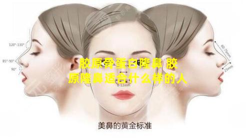胶原骨蛋白隆鼻 胶原隆鼻适合什么样的人